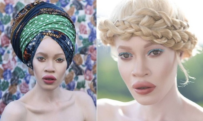 Уникальная красота: афроамериканка-альбинос стала востребованной моделью